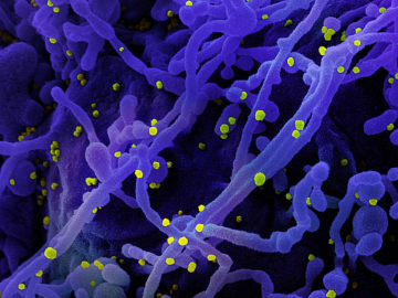 Colorized scanning electron micrograph of a cell (purple) infected with SARS-COV-2 virus particles (yellow), isolated from a patient sample. Image captured at the NIAID Integrated Research Facility (IRF) in Fort Detrick, Maryland.